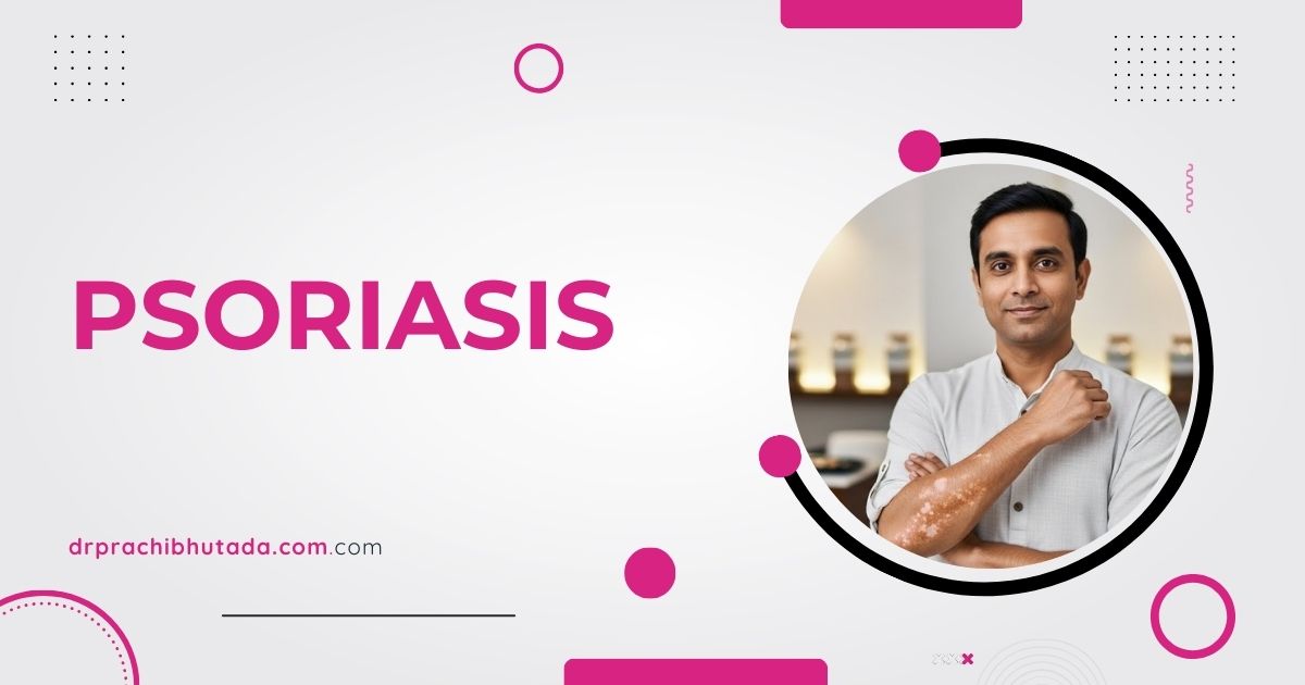 psoriasis-ayurvedic-treatment-sparsh-clinic-nagpur